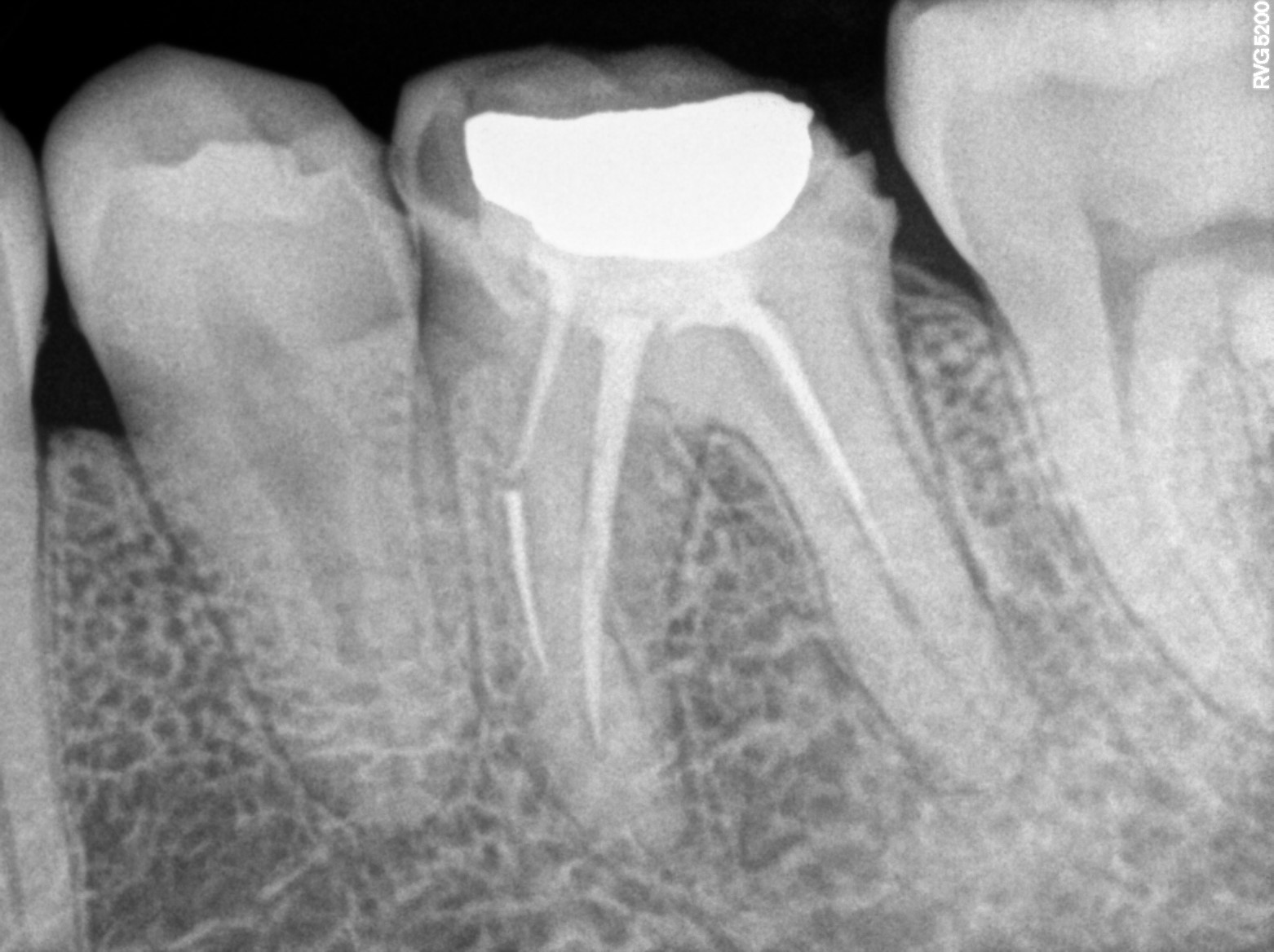 Dental X-ray